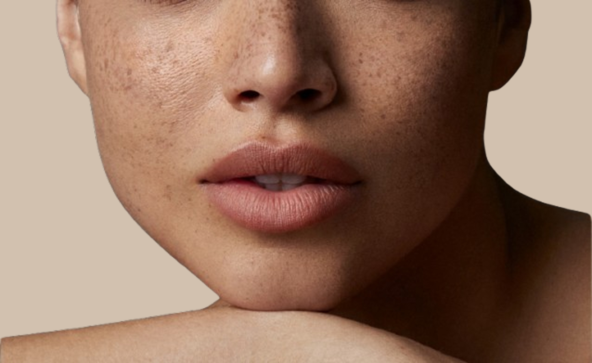 Non-surgical aesthetic treatments in Brussels – Dr. Alexandru Paun